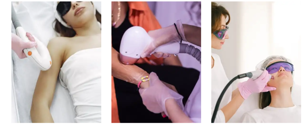 laserska epilacija nis 1024x428