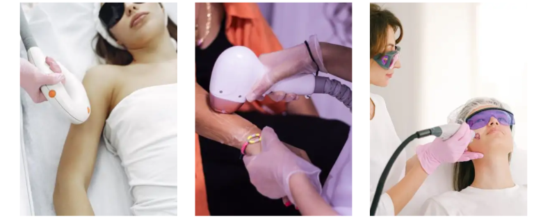 laserska epilacija nis 768x321